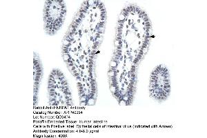Immunohistochemistry (IHC) image for anti-Heterogeneous Nuclear Ribonucleoprotein A1 (HNRNPA1) (C-Term) antibody (ABIN2778790)