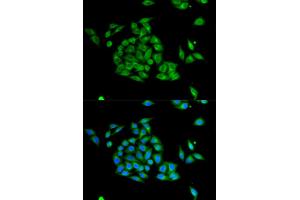 Immunofluorescence analysis of HeLa cells using PICK1 antibody (ABIN6291515).