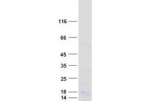 Validation with Western Blot (RSRC2 Protein (Transcript Variant 1) (Myc-DYKDDDDK Tag))