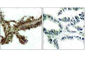 Image no. 1 for anti-V-Akt Murine Thymoma Viral Oncogene Homolog 1 (AKT1) (pThr308) antibody (ABIN196711) (AKT1 antibody  (pThr308))