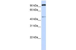 WB Suggested Anti-TRIM15 Antibody Titration: 0. (TRIM15 antibody  (Middle Region))