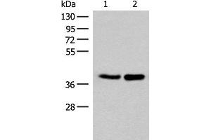 Western blot analysis of HUVEC and PC3 cell lysates using FAM84B Polyclonal Antibody at dilution of 1:400 (FAM84B antibody)