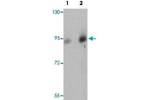 Western blot analysis of human brain tissue with DCLK1 polyclonal antibody  at (Lane 1) 0. (DCLK1 antibody  (N-Term))