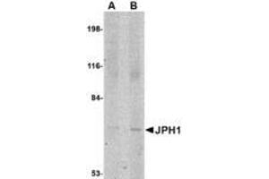 Image no. 1 for anti-Junctophilin 1 (JPH1) (C-Term) antibody (ABIN341697) (Junctophilin 1 antibody  (C-Term))
