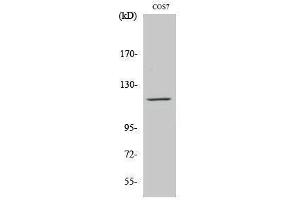 Western Blotting (WB) image for anti-PTK2B Protein tyrosine Kinase 2 beta (PTK2B) (Ser373) antibody (ABIN3186607) (PTK2B antibody  (Ser373))
