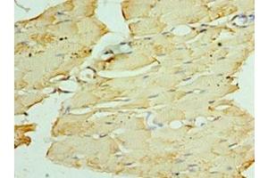 Immunohistochemistry of paraffin-embedded human skeletal muscle tissue using ABIN7162696 at dilution of 1:100 (PNPLA2 antibody  (AA 265-504))
