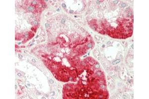Formalin-fixed and paraffin-embedded H. (MGAT3 antibody  (N-Term))