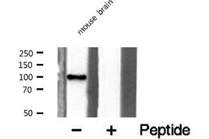 Western blot analysis of extracts from mouse brain cells, using GCN5L2 antibody. (KAT2A antibody  (C-Term))