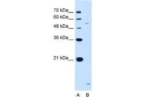 WB Suggested Anti-ST3GAL5 Antibody Titration:  1. (ST3GAL5 antibody  (N-Term))