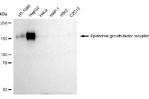Western blotting analysis using Epidermal growth factor receptor antibody (ABIN7798476). (EGFR antibody)