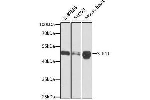 Western blot analysis of extracts of various cell lines, using STK11 antibody. (LKB1 antibody  (AA 134-433))