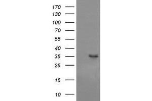 Western Blotting (WB) image for anti-T-cell surface glycoprotein CD1c (CD1C) antibody (ABIN2670669) (CD1c antibody)