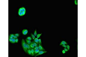 Immunofluorescent analysis of PC-3 cells using ABIN7142238 at dilution of 1:100 and Alexa Fluor 488-congugated AffiniPure Goat Anti-Rabbit IgG(H+L) (PSMC5 antibody  (Regulatory Subunit 8))