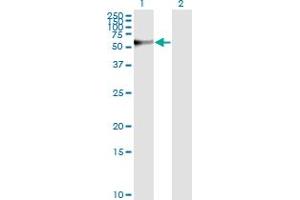 Western Blot analysis of STIP1 expression in transfected 293T cell line by STIP1 monoclonal antibody (M01), clone 4B6. (STIP1 antibody  (AA 1-543))