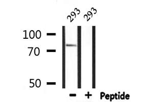 Western blot analysis of extracts from 293, using ADD3 Antibody. (ADD3 antibody  (Internal Region))