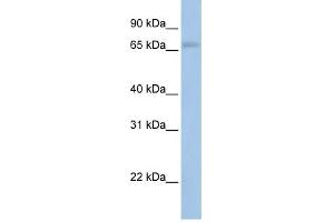 MAP3K2 antibody used at 1 ug/ml to detect target protein. (MAP3K2 antibody  (N-Term))