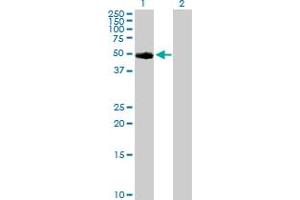 Western Blot analysis of TYR expression in transfected 293T cell line by TYR MaxPab polyclonal antibody. (TYR antibody  (AA 1-377))