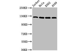 Western Blot Positive WB detected in: Jurkat whole cell lysate, Hela whole cell lysate, K562 whole cell lysate, A549 whole cell lysate All lanes: POLD1 antibody at 5 μg/mL Secondary Goat polyclonal to rabbit IgG at 1/50000 dilution Predicted band size: 124 kDa Observed band size: 124 kDa (POLD1 antibody  (Catalytic Subunit))