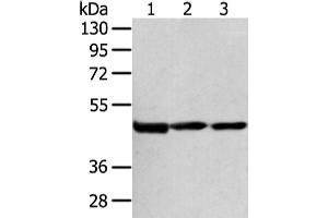 Western Blotting (WB) image for anti-1-Acylglycerol-3-Phosphate O-Acyltransferase 9 (AGPAT9) antibody (ABIN5960644) (AGPAT9 antibody)