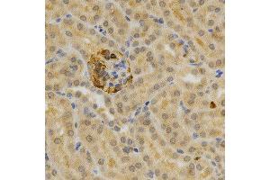 Immunohistochemistry of paraffin-embedded mouse kidney using TNFRSF11B antibody at dilution of 1:200 (x400 lens)
