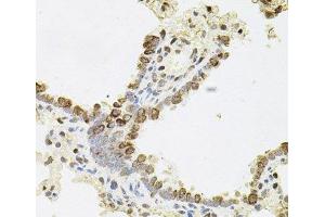 Immunohistochemistry of paraffin-embedded Rat lung using REG3A Polyclonal Antibody (REG3A antibody)
