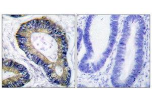Immunohistochemistry (IHC) image for anti-Eukaryotic Translation Initiation Factor 4E Binding Protein 1 (EIF4EBP1) (Thr70) antibody (ABIN1847930) (eIF4EBP1 antibody  (Thr70))