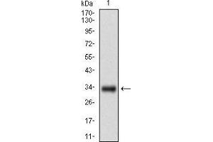 Western blot analysis using GSC mAb against human GSC recombinant protein. (GSC antibody  (AA 191-257))