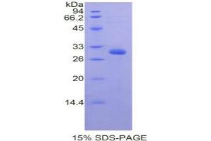 SDS-PAGE analysis of Mouse PRDM1 Protein.