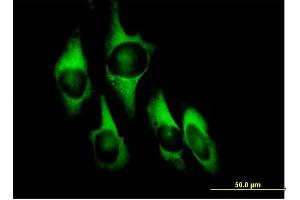 Immunofluorescence of purified MaxPab antibody to EEF1D on HeLa cell. (EEF1D antibody  (AA 1-281))