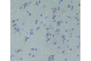 #VALUE! (Protein Tyrosine Phosphatase Receptor Type Z (AA 32-189) antibody)