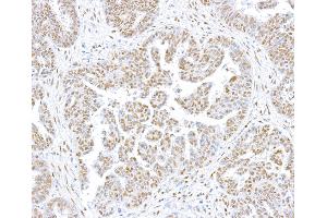 Immunohistochemistry (IHC) image for anti-CCCTC-Binding Factor (Zinc Finger Protein) (CTCF) (AA 650-700) antibody (ABIN7453967)