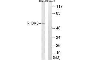 Western blot analysis of extracts from HepG2 cells, using RIOK3 antibody. (RIOK3 antibody)