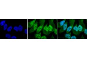 Immunocytochemistry/Immunofluorescence analysis using Rabbit Anti-Phosphothreonine Polyclonal Antibody (ABIN361757). (Phosphothreonine antibody)
