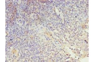 Immunohistochemistry of paraffin-embedded human tonsil tissue using ABIN7158082 at dilution of 1:100 (LRRN1 antibody  (AA 26-631))