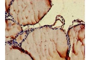Immunohistochemistry of paraffin-embedded human thyroid tissue using ABIN7145998 at dilution of 1:100 (CCL3 antibody  (AA 25-81))