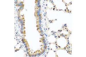 Immunohistochemistry of paraffin-embedded rat lung using C8orf4 antibody at dilution of 1:100 (40x lens). (C8orf4 antibody)
