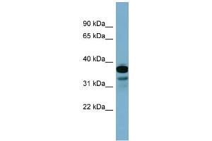 WB Suggested Anti-FLJ25791 Antibody Titration: 0. (FLJ25791 (Middle Region) antibody)