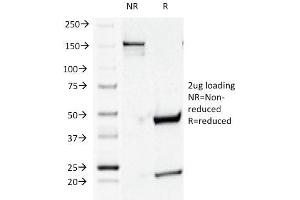 SDS-PAGE Analysis Purified CD44v4 Mouse Monoclonal Antibody (CD44v4/1219). (CD44 antibody)