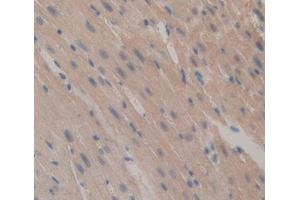 Used in DAB staining on fromalin fixed paraffin- embedded Kidney tissue (Caspase 12 antibody  (AA 1-413))