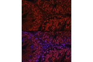Immunofluorescence analysis of rat testis using C1orf146 Rabbit pAb (ABIN7266368) at dilution of 1:100 (40x lens). (C1ORF146 antibody)