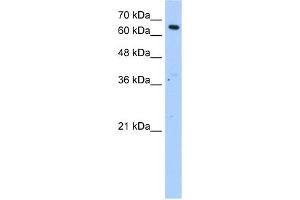 WB Suggested Anti-MLSTD2 Antibody Titration:  1. (FAR1 antibody  (N-Term))