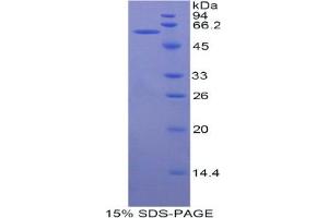 SDS-PAGE analysis of Human MACC1 Protein.