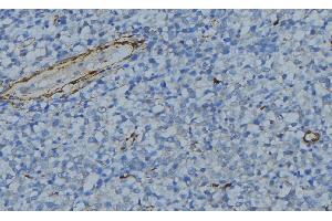 ABIN6275030 at 1/100 staining Human uterus tissue by IHC-P.