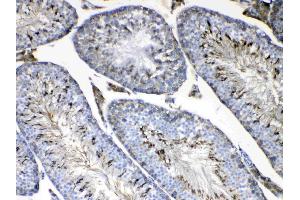 IHC analysis of FMN1 using anti-FMN1 antibody . (FMN1 antibody  (AA 1195-1419))