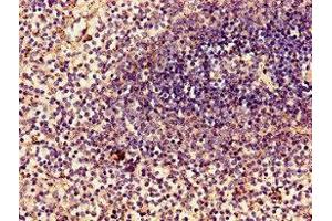 Immunohistochemistry of paraffin-embedded human spleen tissue using ABIN7160551 at dilution of 1:100