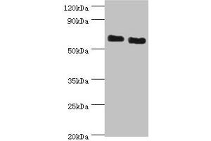 Western blot All lanes: ATAD3B antibody at 2 μg/mL Lane 1: Jurkat whole cell lysate Lane 2: Hela whole cell lysate Secondary Goat polyclonal to rabbit IgG at 1/10000 dilution Predicted band size: 73, 20, 68 kDa Observed band size: 73 kDa (ATAD3B antibody  (AA 1-240))