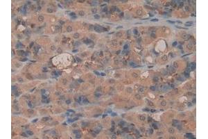 Detection of LPO in Rat Intestine Tissue using Polyclonal Antibody to Lactoperoxidase (LPO)