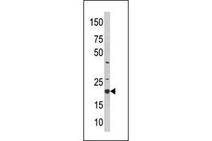 Western blot analysis of anti-SKP1A Pab (ABIN388650 and ABIN2838369) in CEM cell line lysate (35 μg/lane). (SKP1 antibody  (AA 58-87))