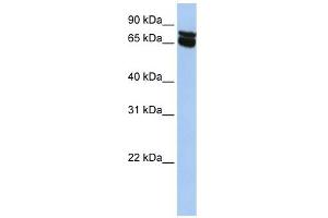 B4GALNT1 antibody used at 1 ug/ml to detect target protein. (B4GALNT1 antibody  (N-Term))