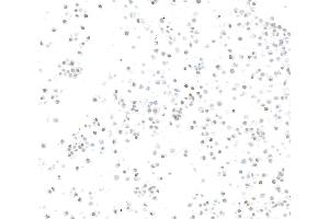 Immunocytochemistry (ICC) image for anti-SWI/SNF Related, Matrix Associated, Actin Dependent Regulator of Chromatin, Subfamily A, Member 2 (SMARCA2) (AA 100-150) antibody (ABIN7795711)